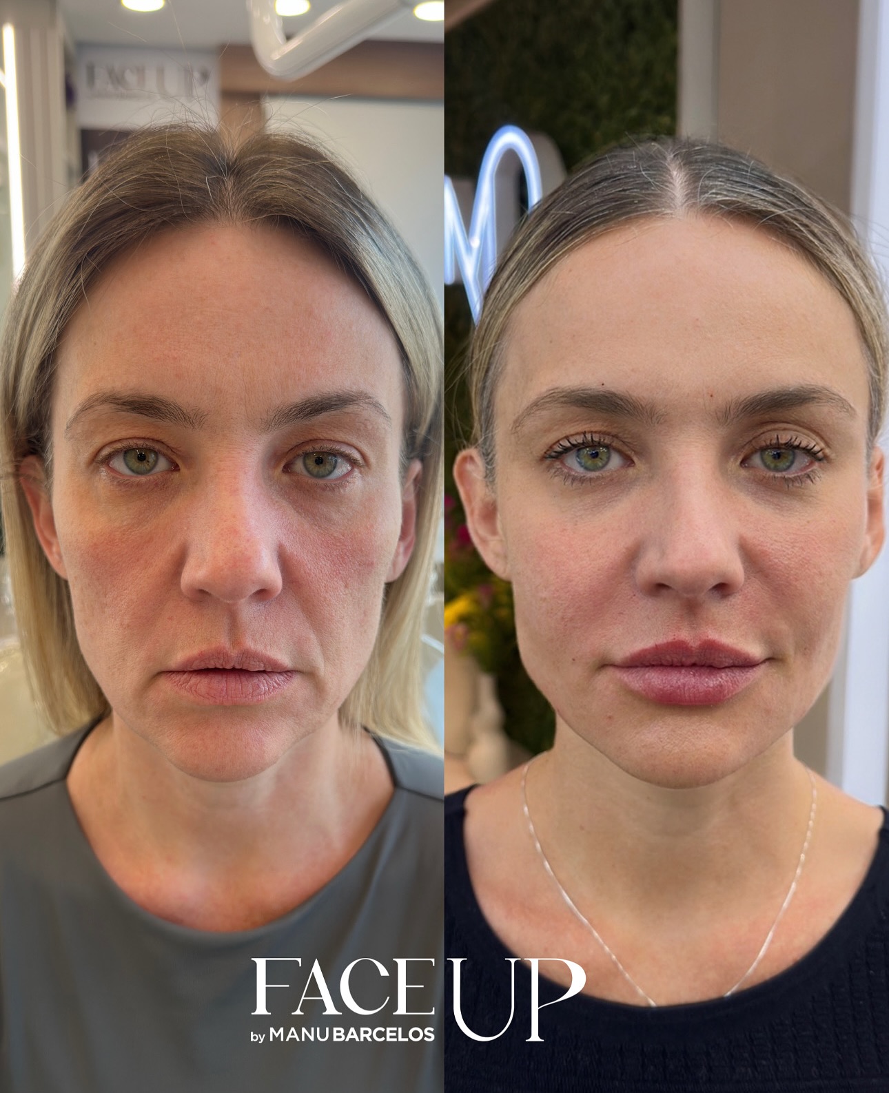 Antes e depois — FACE UP by Manu Barcelos